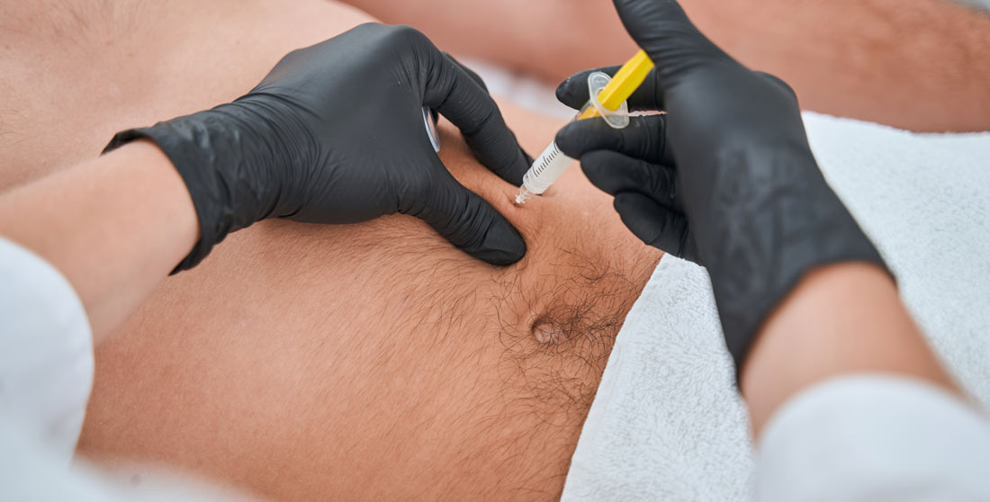 Fat Dissolving Injections